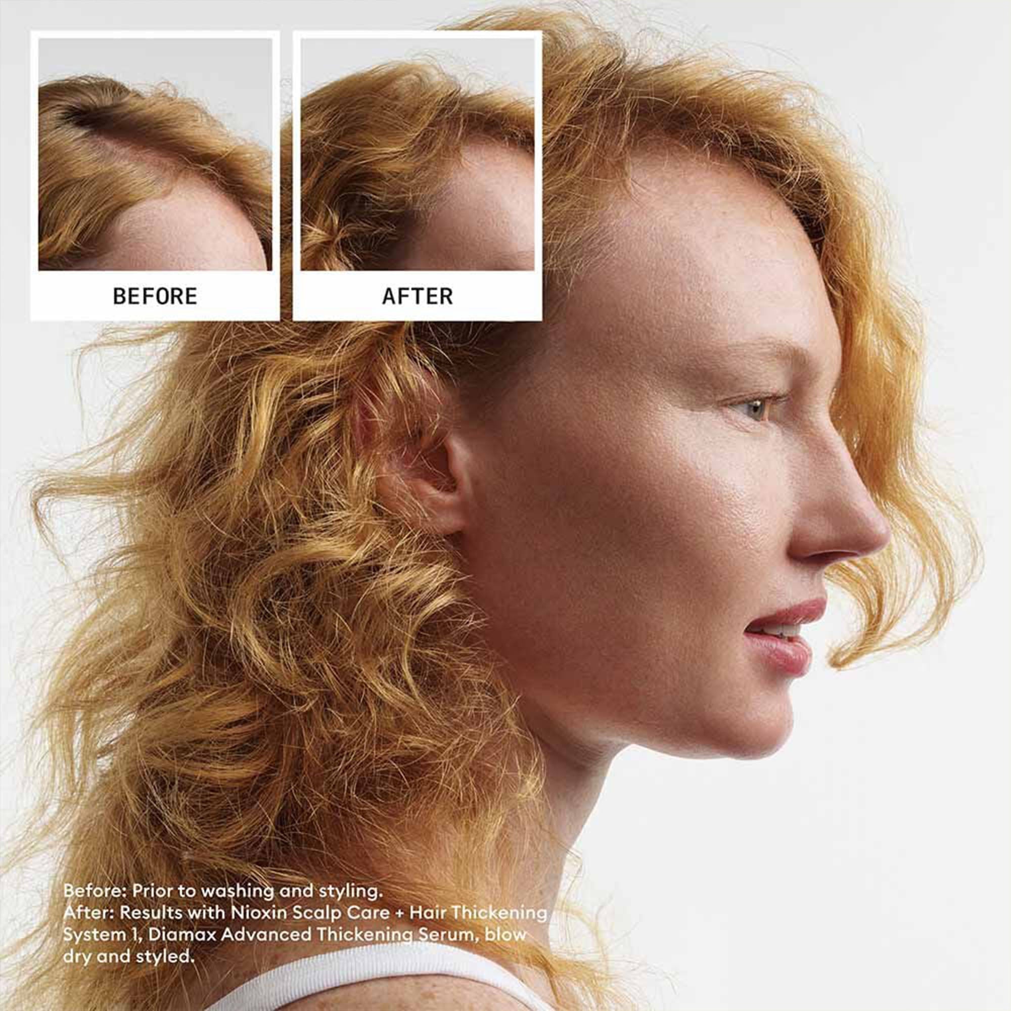 Nioxin - Scalp + Hair Thickening System 1 Kit