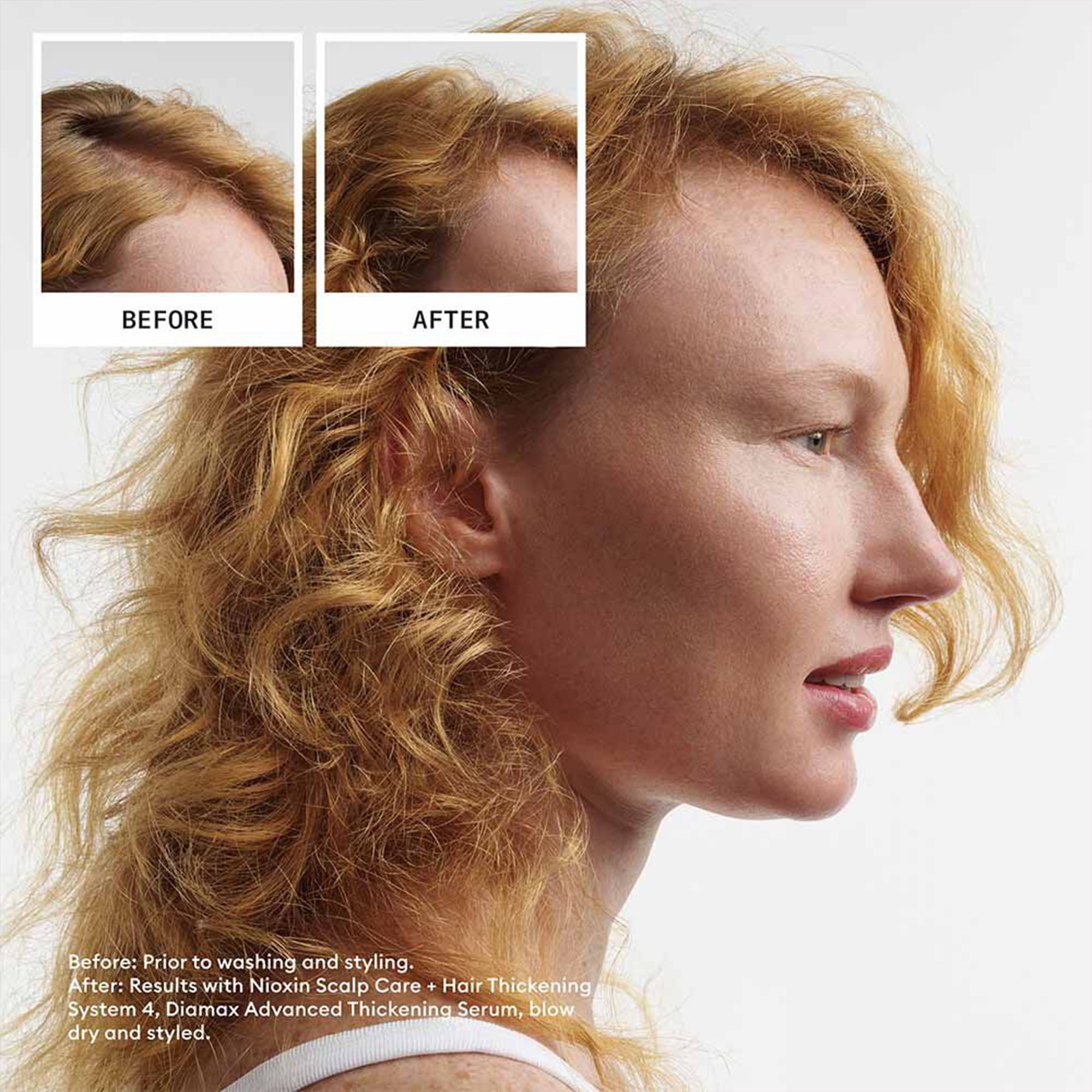 Nioxin - Scalp + Hair Thickening System 4 Kit